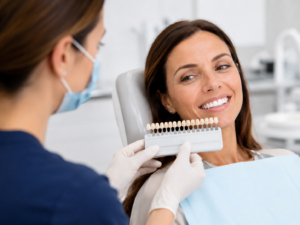 Sbiancamento Professionale Denti
